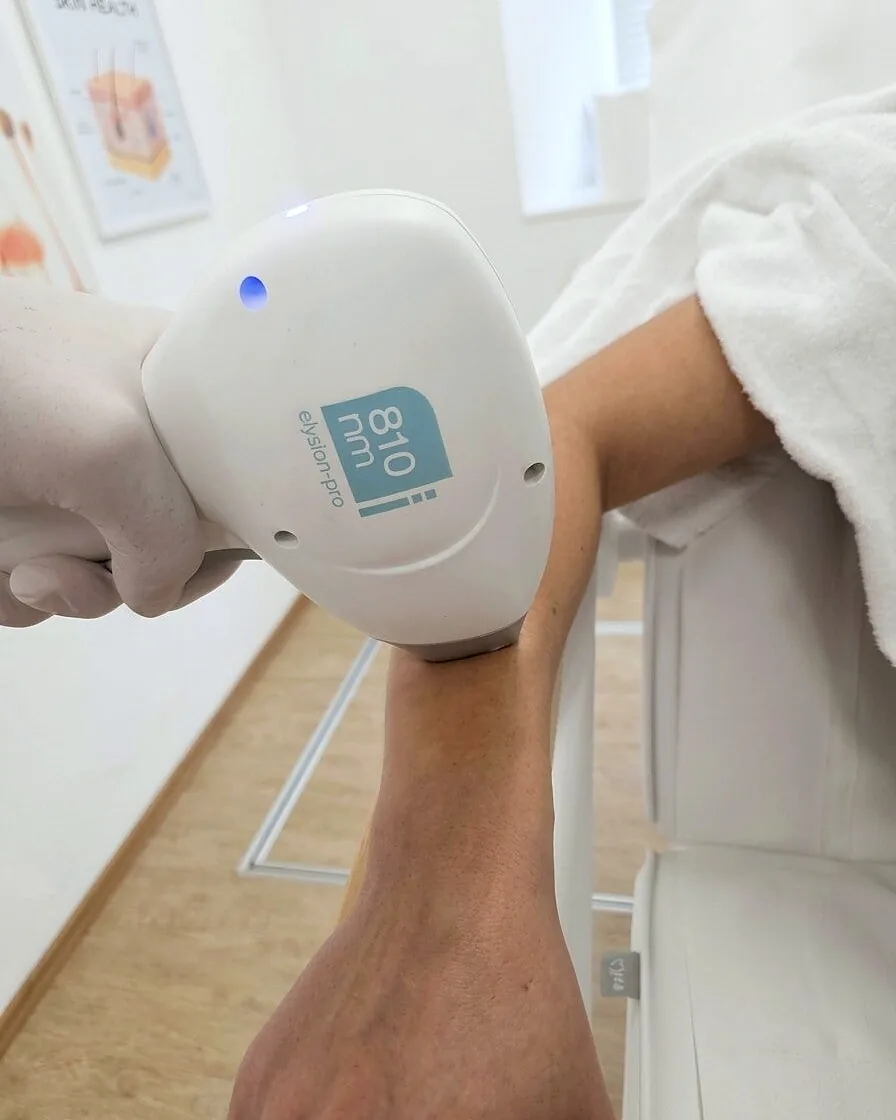 Laser-Haarentfernung am Arm im Studio Twins Beauty
